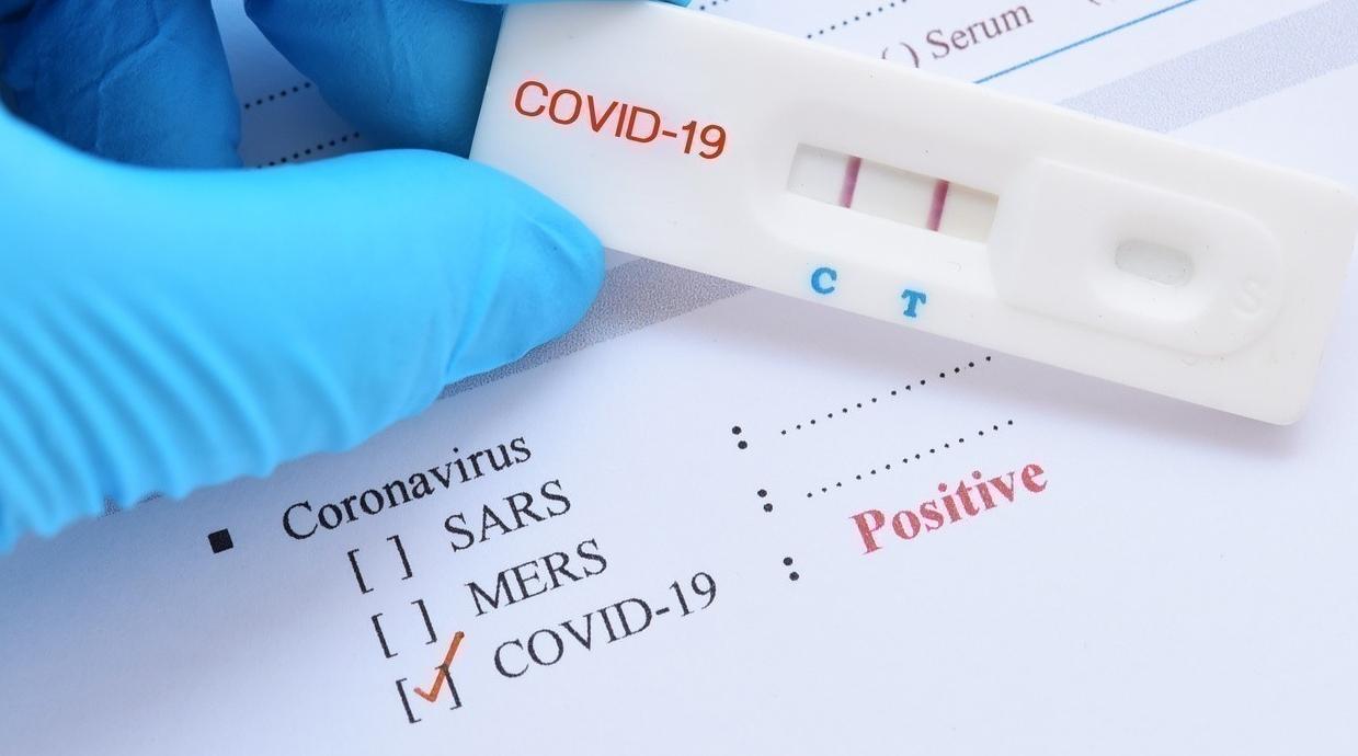 Maroc/Covid-19 : Aucun décès à déplorer en 24H, 52 nouvelles infections recensés